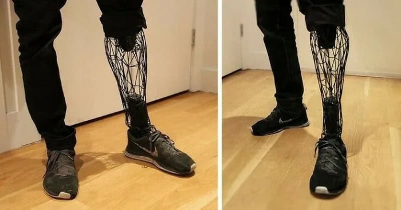 3D printed prosthetic leg on a person's leg, black with a wireframe design.