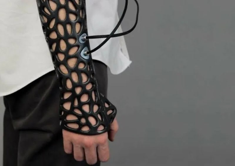 3D printed black lattice arm brace on a person's arm, with laces and a white shirt sleeve.