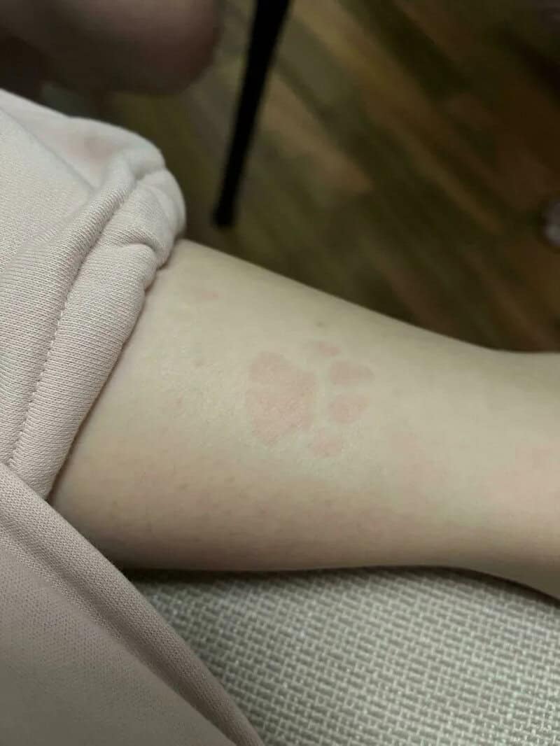Faint pinkish handprint on person's forearm, sitting on a beige surface.