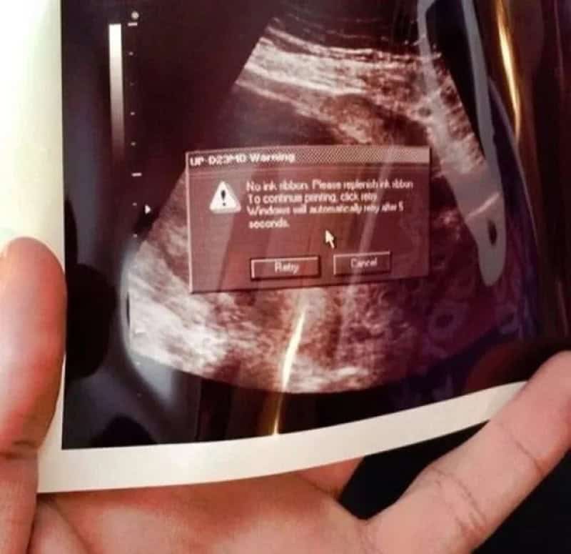Ultrasound image with a warning message overlay about a no-kick button error.