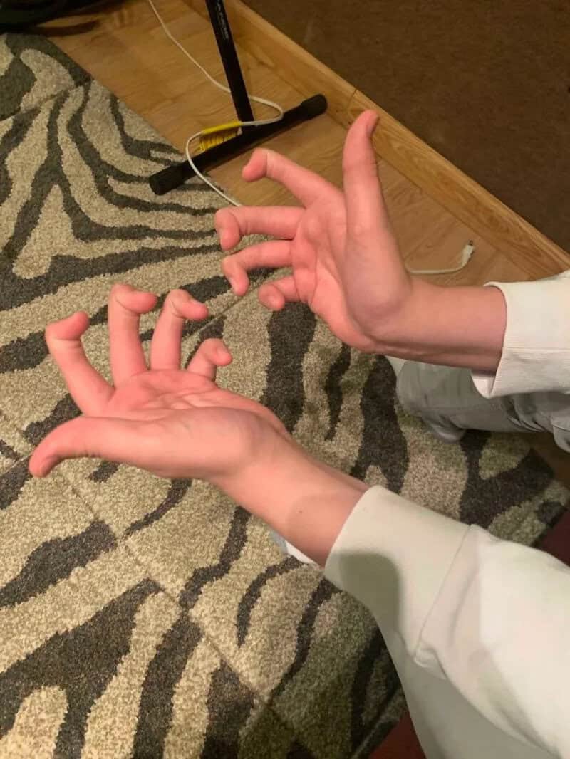 Two hands with fingers forming unique shapes, one hand with three fingers up.