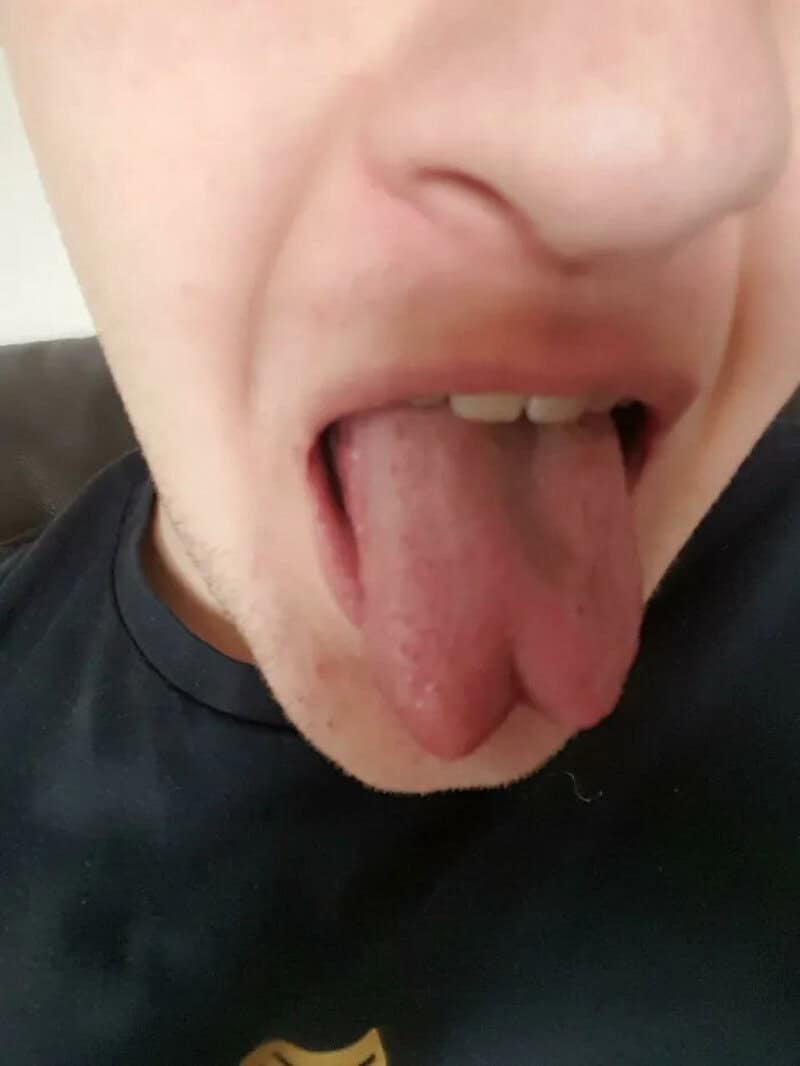 Close-up of a person sticking out their tongue, showing a tongue piercing.