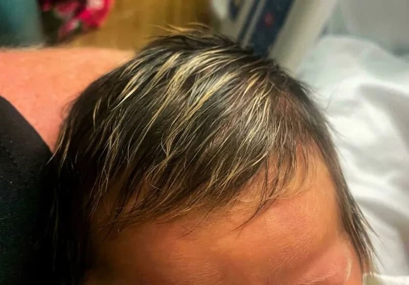 Close-up of a person's head showing a unique hair pattern and color.