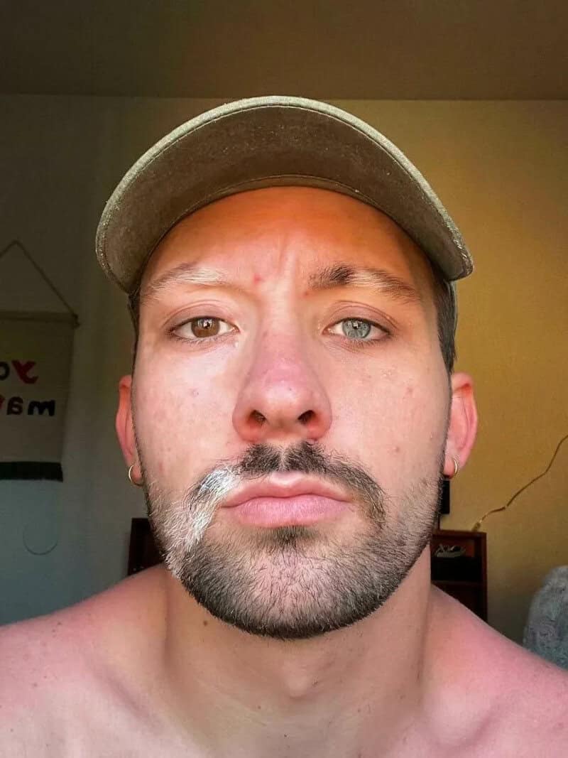 Close-up of a man with heterochromia, wearing a cap, with a serious expression.