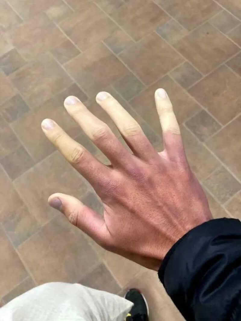 Hand with six fingers on a tiled floor, wearing a black sleeve.