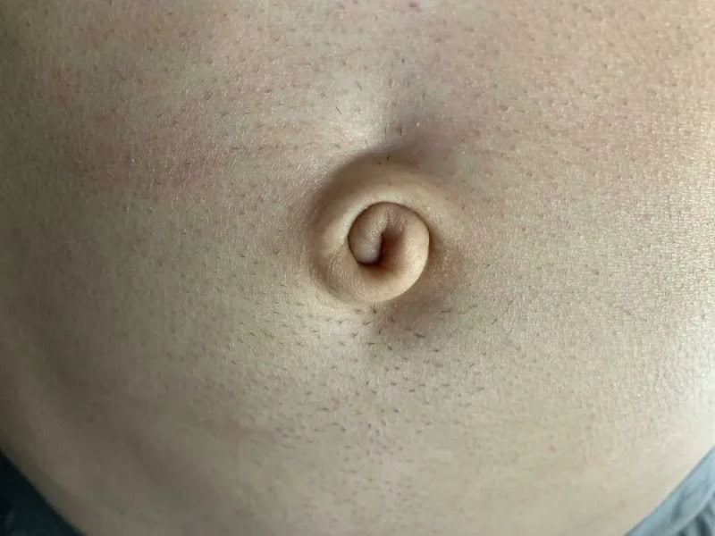 Close-up of a belly button with a spiral shape.