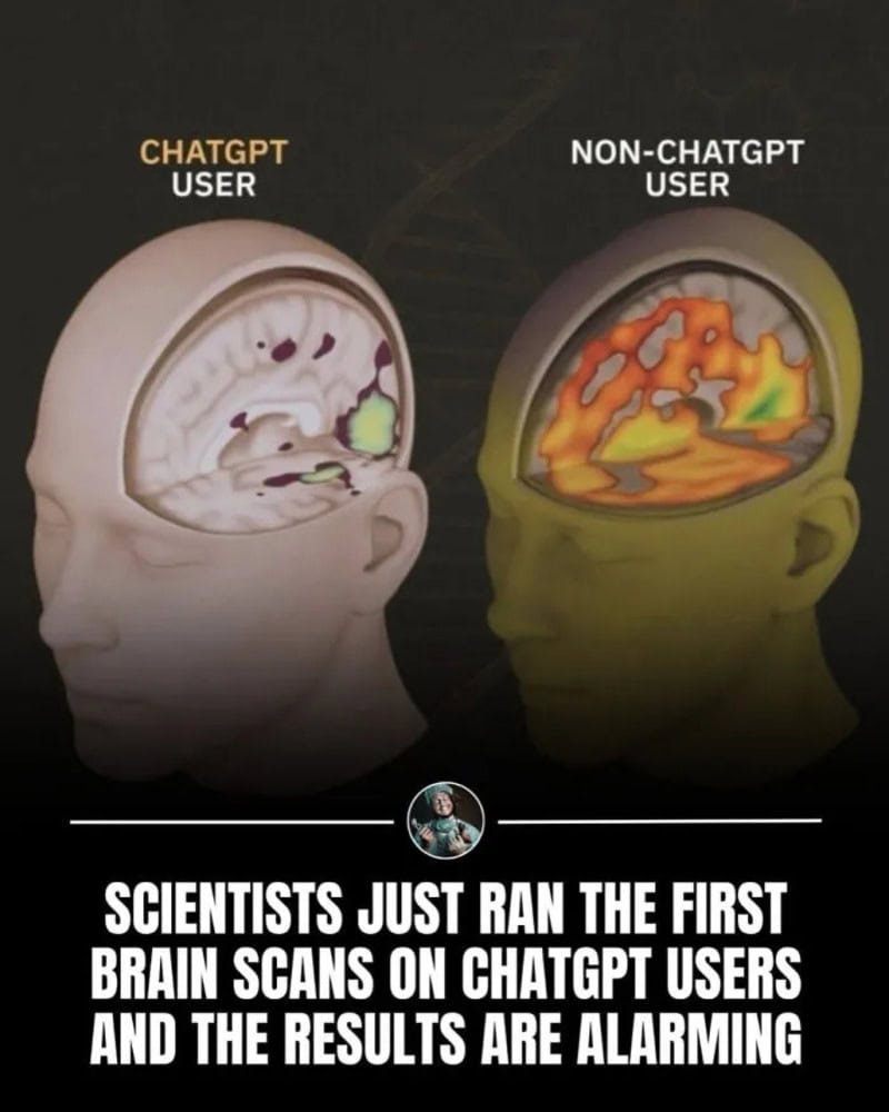 Comparison of ChatGPT and non-ChatGPT user brain scans with a caption about scientists' findings.
