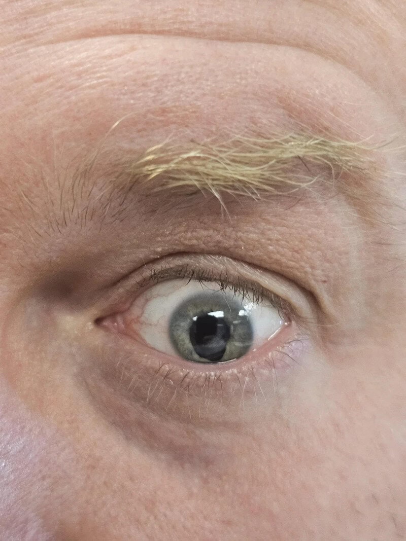 Close-up of a human eye with light-colored eyebrow hairs.