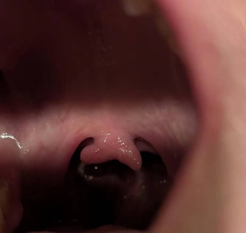 Close-up of a human body part, possibly inside a mouth or throat.
