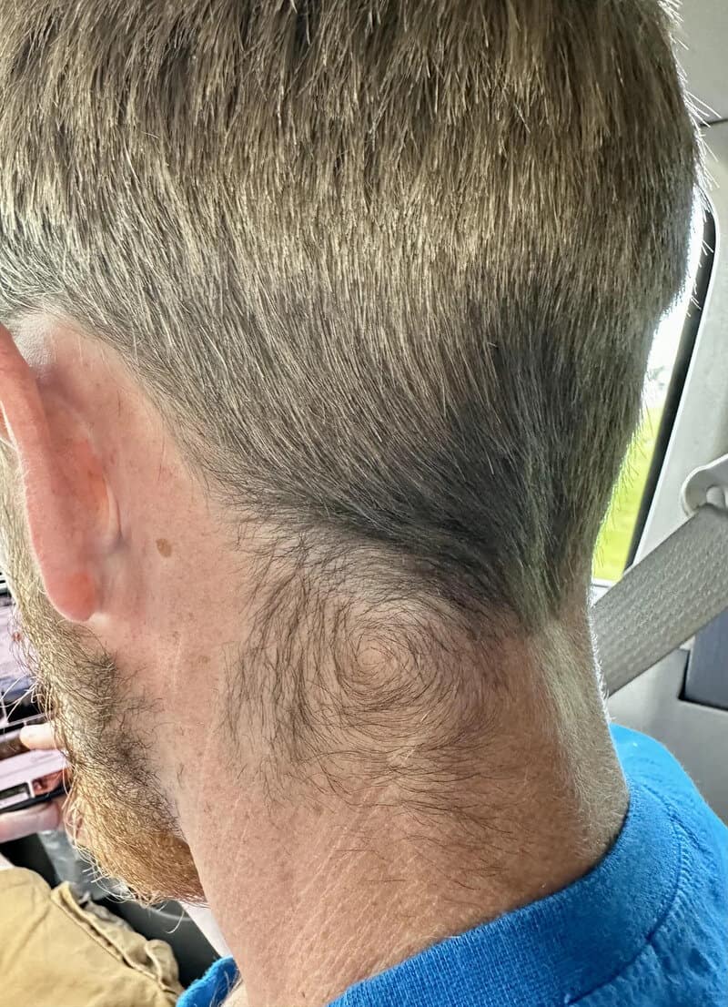 Close-up of the back of a person's head showing short hair and neck skin.