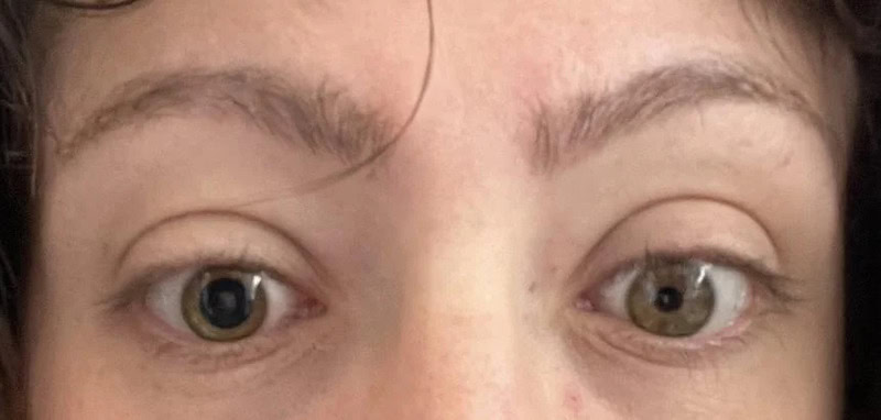 Close-up of a person's eyes and eyebrows, showing natural skin and eye color.