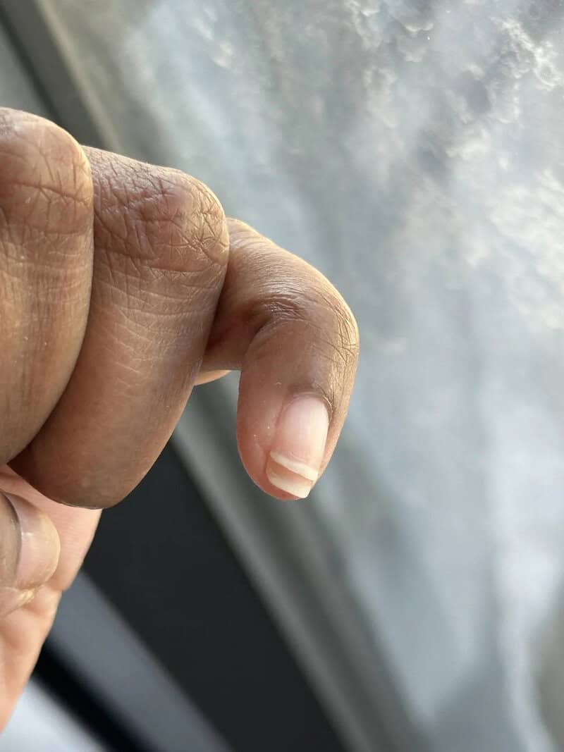 Close-up of a person's finger with a cloudy sky in the background.