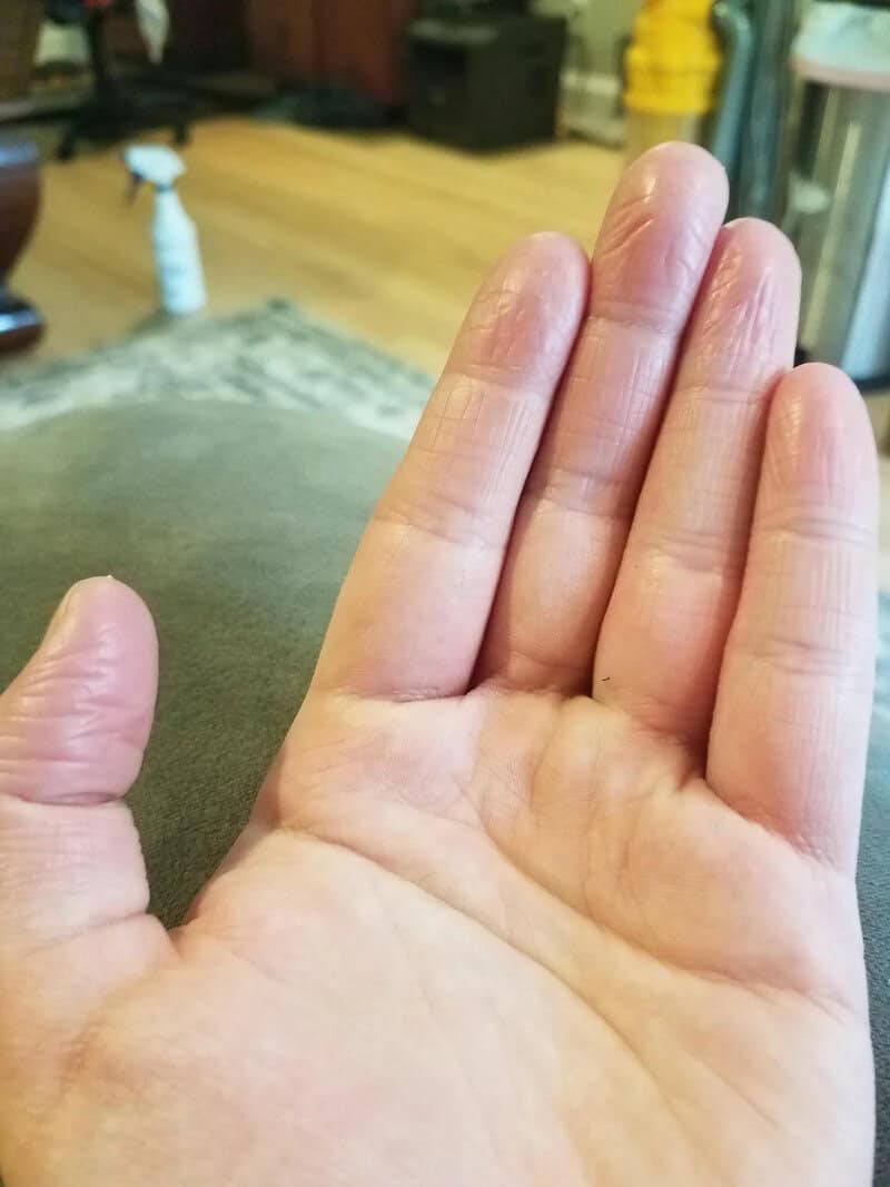 Close-up of a human hand with fingers extended, indoors with a blurred background.