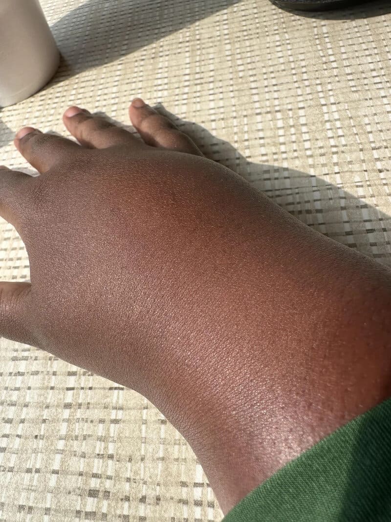 Close-up of a dark-skinned hand resting on a woven surface.
