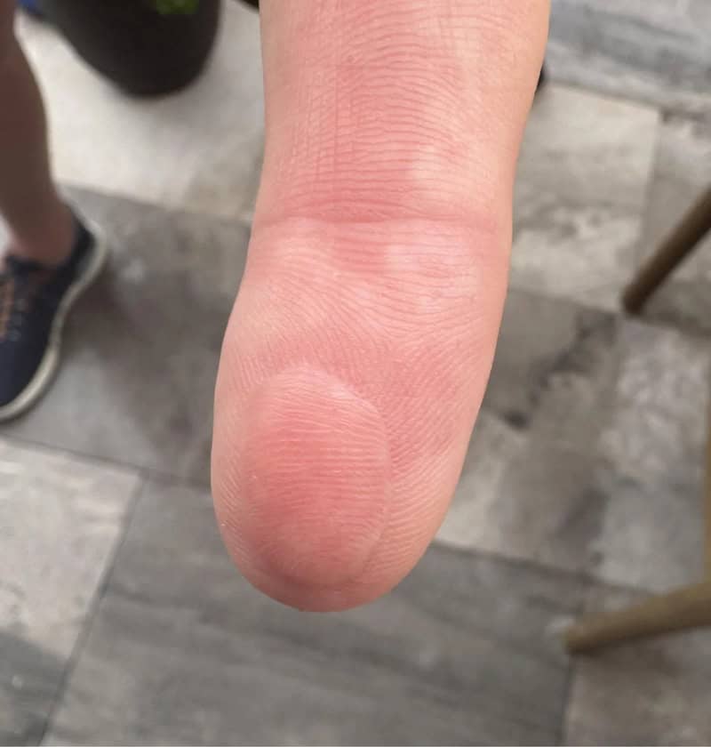 Close-up of a human finger with a blurred background.