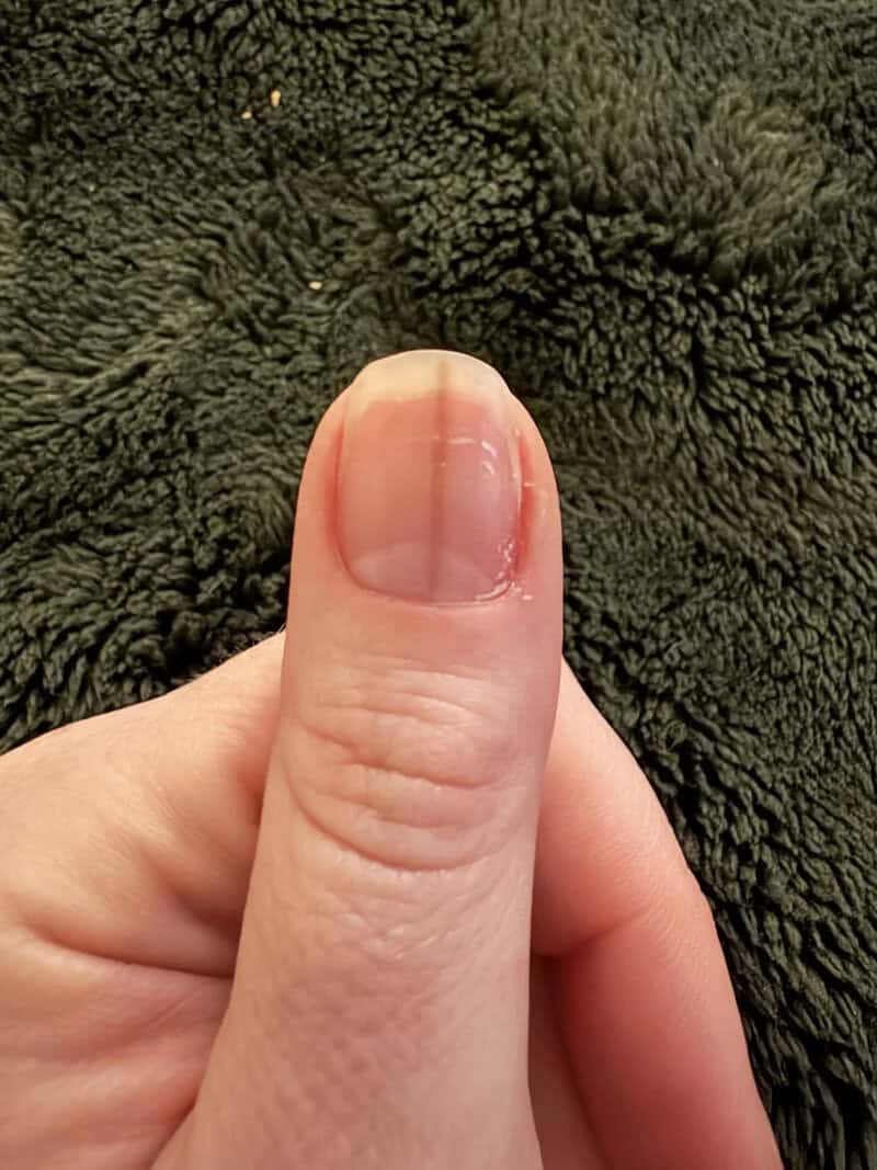 Close-up of a thumb with a background of dark green textured fabric.