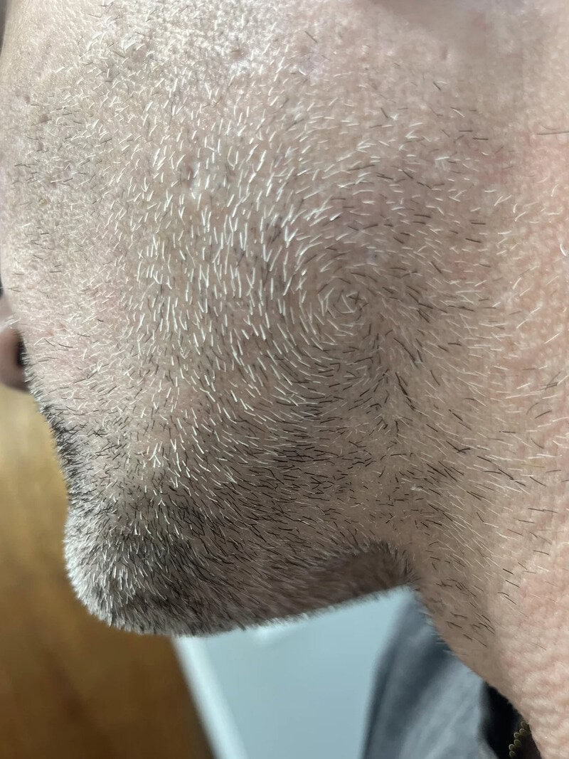 Close-up of a human nose with visible hair and skin texture.