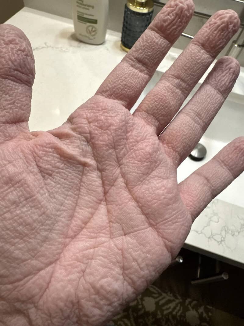 Close-up of a wrinkled, pale human hand with visible veins and lines.