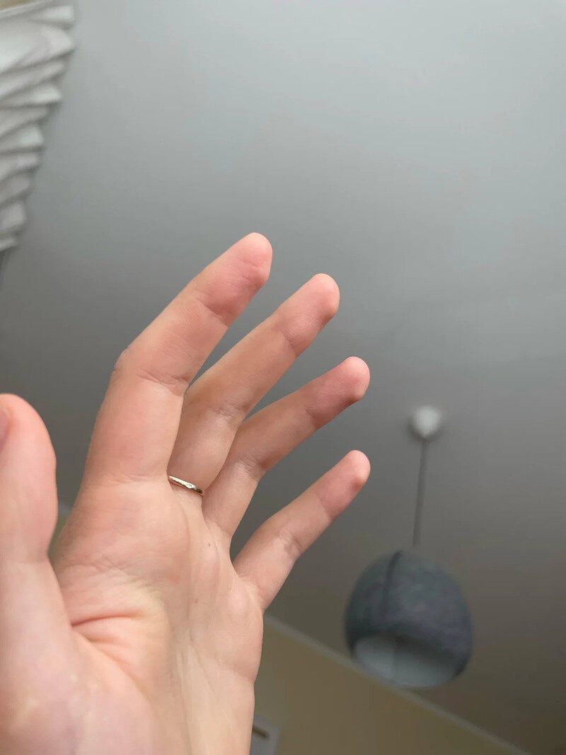 Close-up of a hand with fingers slightly spread, against a plain background.