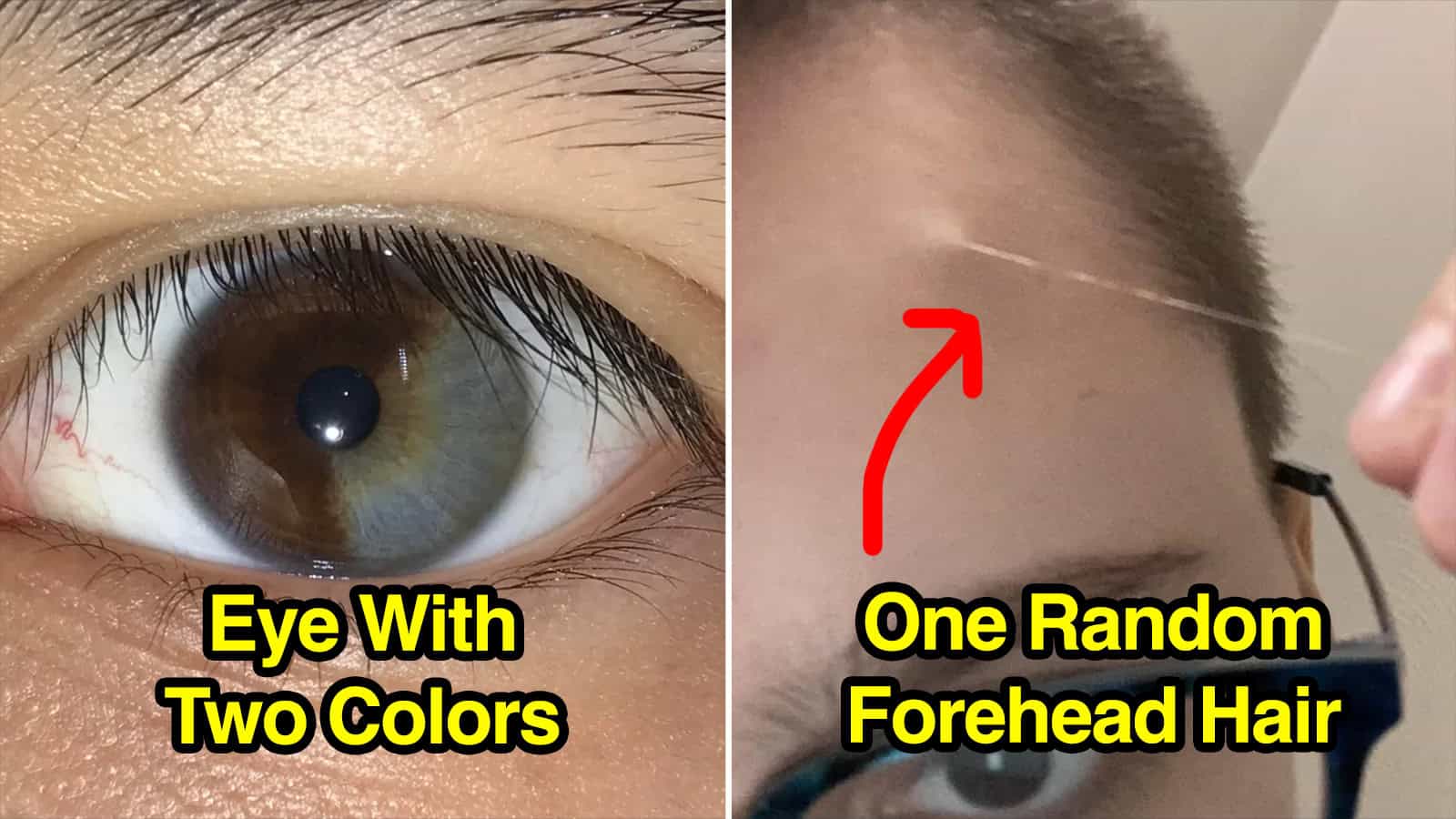 Close-up of eye with two different colors and a forehead with random hair.