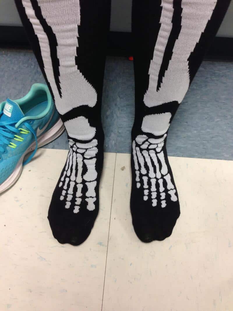 Person wearing black tights with white skeleton bone pattern standing on a tiled floor, teal sneaker.