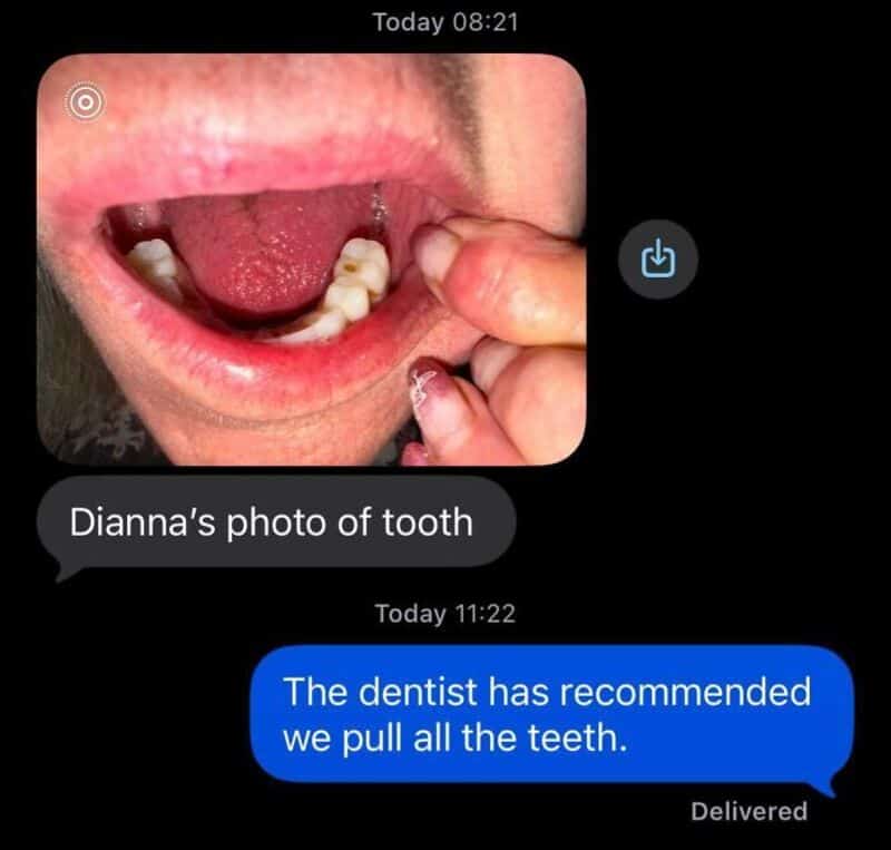 Photo of a person's open mouth showing missing and decayed teeth.