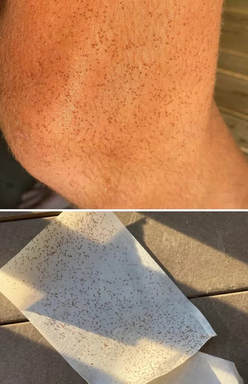 Close-up of a person's skin with blackheads and a paper towel with blackheads on it.